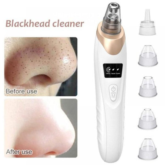 Blackhead Suction Remover – LED Display Pore Cleaner with Multi Suction Levels
