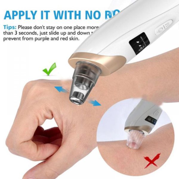 Blackhead Suction Remover – LED Display Pore Cleaner with Multi Suction Levels