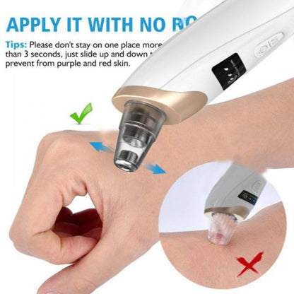 Blackhead Suction Remover – LED Display Pore Cleaner with Multi Suction Levels